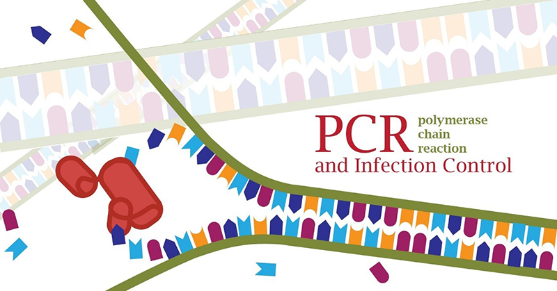 Xét nghiệm lao bằng phương pháp PCR cho kết quả sau khoảng 1 - 2 ngày lấy mẫu