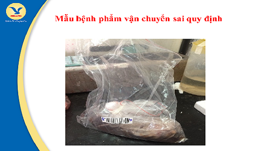 Lưu ý trong cách lấy mẫu, bảo quản và vận chuyển bệnh phẩm giải phẫu bệnh - tế bào