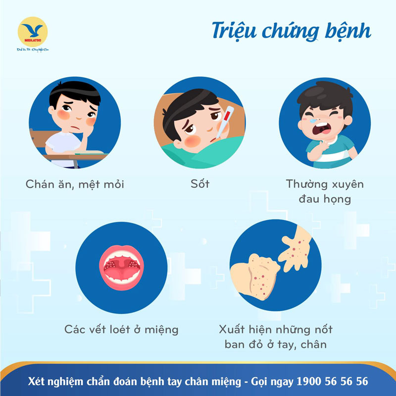 Biểu hiện của bệnh tay chân miệng khác nhau qua từng giai đoạn