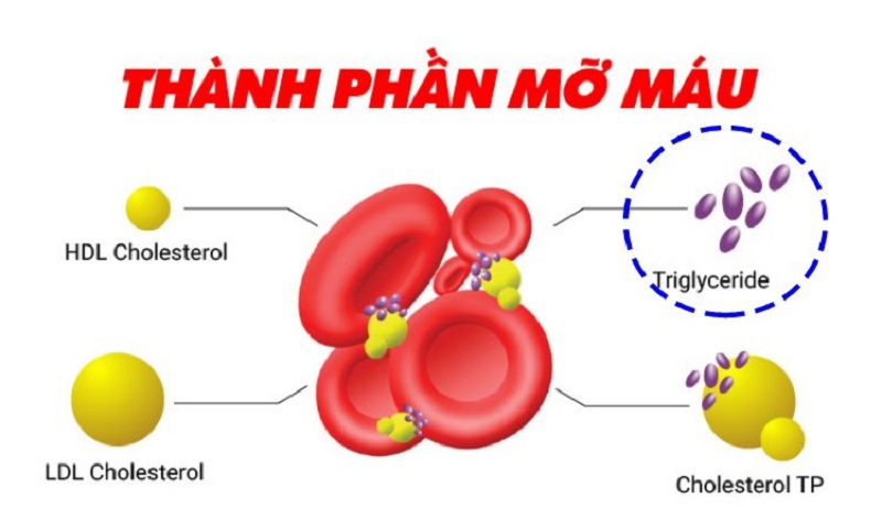 Mô phỏng giúp hình dung chỉ số Triglyceride là gì